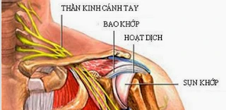 Đau vùng quanh vai, không thể coi thường