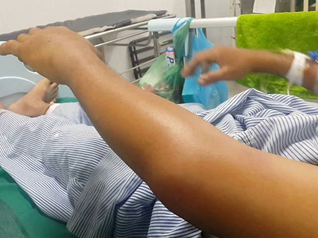Nguy kịch vì nặn máu độc để chữa... rắn cắn