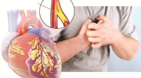 Phát hiện sớm dấu hiệu bệnh tim mạch - Ảnh 1 Phat hien som dau hieu benh tim mach - Anh 1