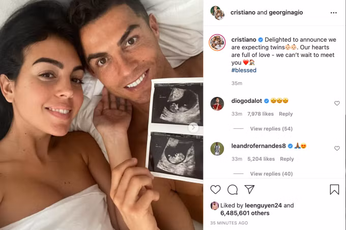 Ronaldo và bạn gái Georgina khoe ảnh siêu âm mang song thai.