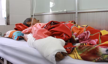 Dao ho trong cay trung bom, hai bo con mat tay chan - Anh 1