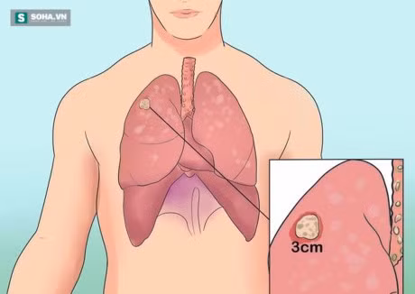 Neu de 6 bo phan nay mang benh, nam gioi nhieu nguy co chet som - Anh 2