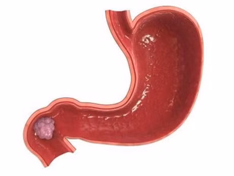 Neu de 6 bo phan nay mang benh, nam gioi nhieu nguy co chet som - Anh 4