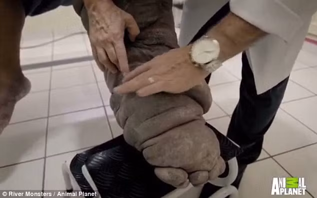 Bị muỗi cắn, người đàn ông bị phù chân voi đáng sợ - Ảnh 1