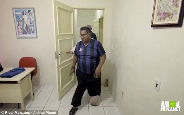 Bị muỗi cắn, người đàn ông bị phù chân voi đáng sợ - Ảnh 2 Bị muỗi cắn, người đàn ông bị phù chân voi đáng sợ - Ảnh 2