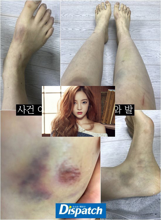 Goo Hara,Goo Hara qua đời,người yêu Goo Hara,Goo Hara bị bạn trai bạo hành,sao Hàn