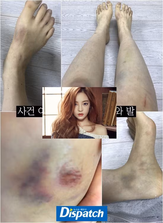Goo Hara,Goo Hara qua đời,người yêu Goo Hara,Goo Hara bị bạn trai bạo hành,sao Hàn