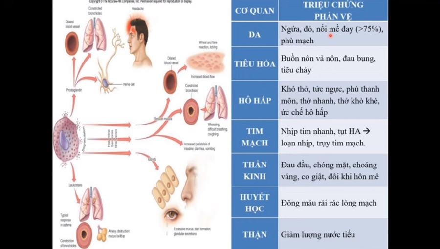 Video: Hướng dẫn theo dõi, xử trí phản ứng sau tiêm chủng vắc xin phòng Covid-19