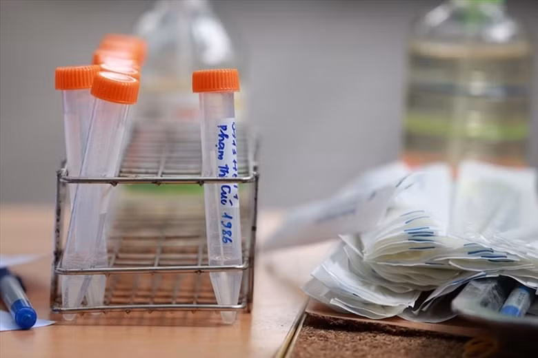 Hà Nội xét nghiệm sàng lọc Covid-19 cho người nguy cơ cao, người sống trong khu vực nguy cơ. Ảnh: Hải Nguyễn.