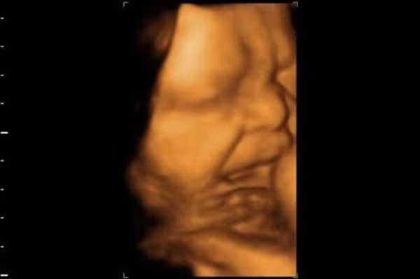 Trẻ không thể phát ra âm thanh khi ở trong bụng mẹ.