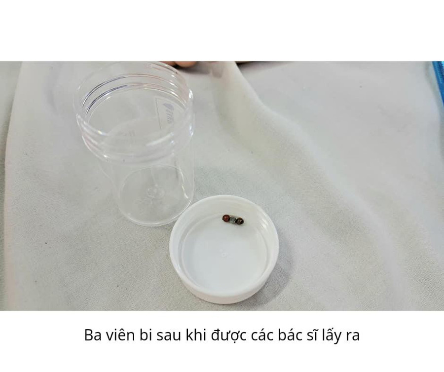 Ảnh: BV. Ảnh: BV.