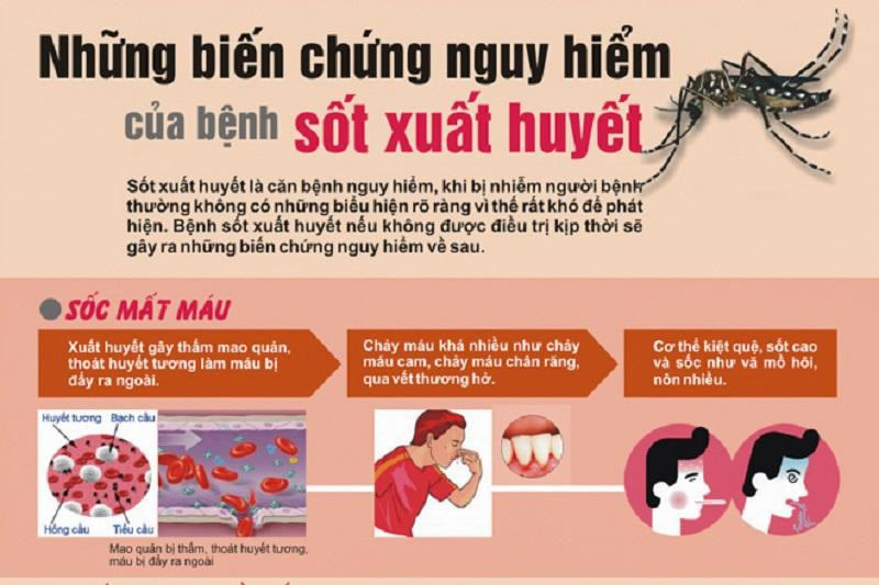 Sốt xuất huyết có thể biến chứng nhanh chóng và dẫn đến tử vong. Ảnh: BV. Sốt xuất huyết có thể biến chứng nhanh chóng và dẫn đến tử vong. Ảnh: BV.