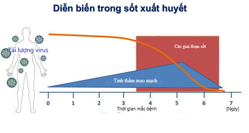 Diễn tiến của bệnh sốt xuất huyết. Ảnh: BV. Diễn tiến của bệnh sốt xuất huyết. Ảnh: BV.
