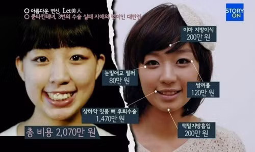 hóa mỹ nhân nhờ thẩm mỹ 