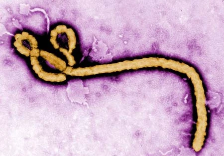 Chính phủ Czech bị tống tiền bằng thư dọa phát tán Ebola