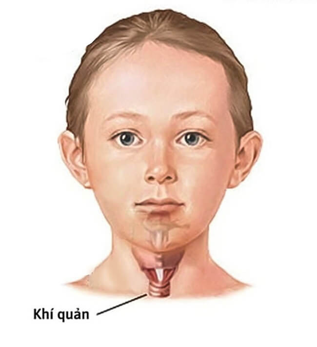 Khí quản là một trong những bộ phận vô cùng quan trọng của hệ hô hấp. Ảnh minh hoạ.