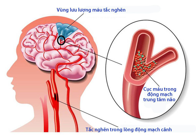 Ảnh minh họa.