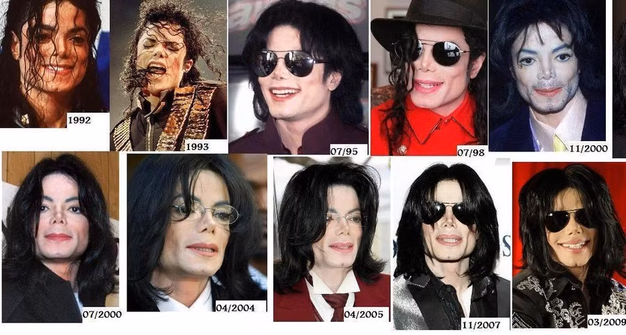 7 cuoc phau thuat tham my dat tien nhat cua sao hollywood hinh anh 5