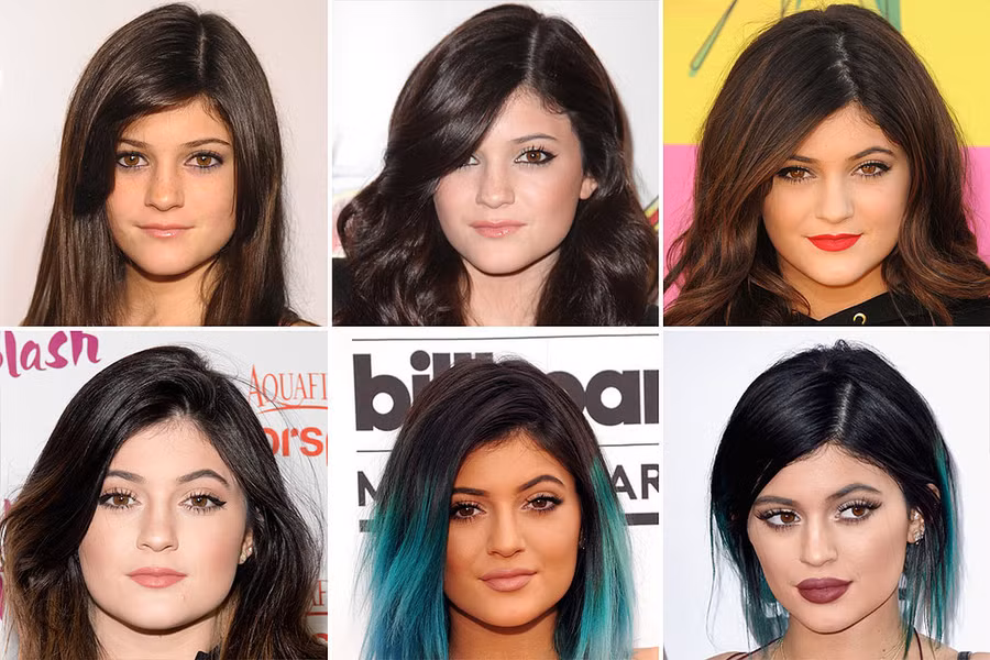 7 cuoc phau thuat tham my dat tien nhat cua sao hollywood hinh anh 6