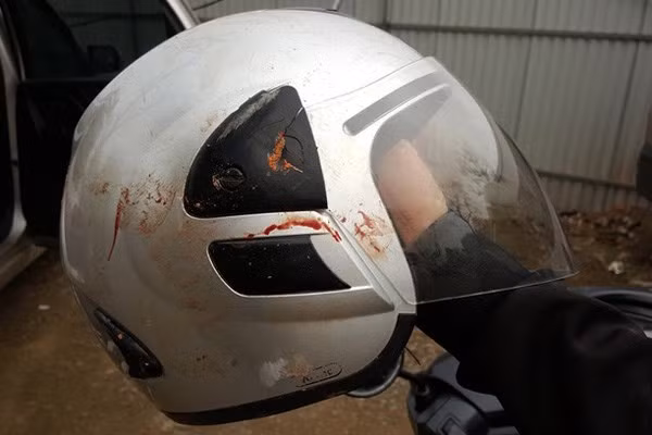 Nhà báo Đỗ Doãn Hoàng dùng tay giữ mũ bảo hiểm nên bị đập dập xương ngón tay. Nhà báo Đỗ Doãn Hoàng dùng tay giữ mũ bảo hiểm nên bị đập dập xương ngón tay.