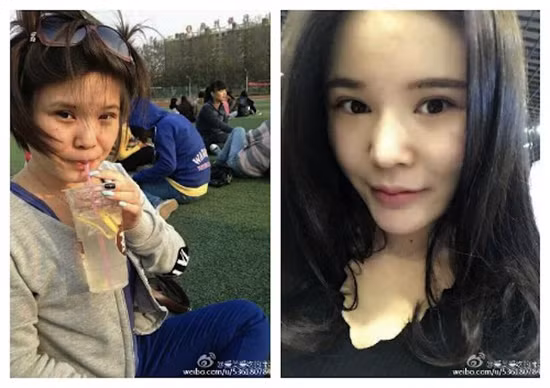 Bị bạn trai "đá" vì béo, thiếu nữ hút mỡ làm xà phòng gửi tặng để trả thù