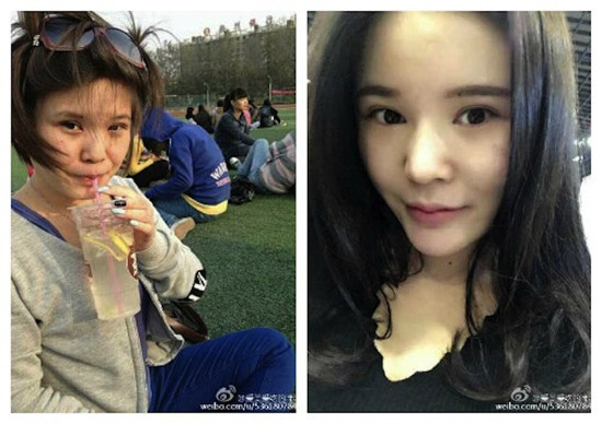 Bị bạn trai "đá" vì béo, thiếu nữ hút mỡ làm xà phòng gửi tặng để trả thù ảnh 1 Xiao Xiao trước và sau khi hút mỡ. Ảnh: Weibo