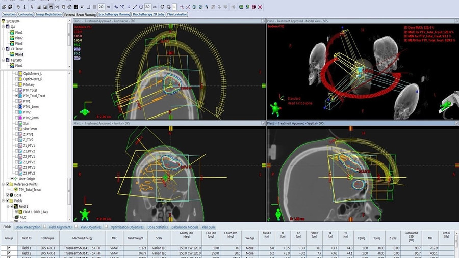 Phẫu thuật u não cho bệnh nhân dưới sự giám sát của Robot thông minh Modus V Synaptive tại BV Đa khoa Tâm Anh.