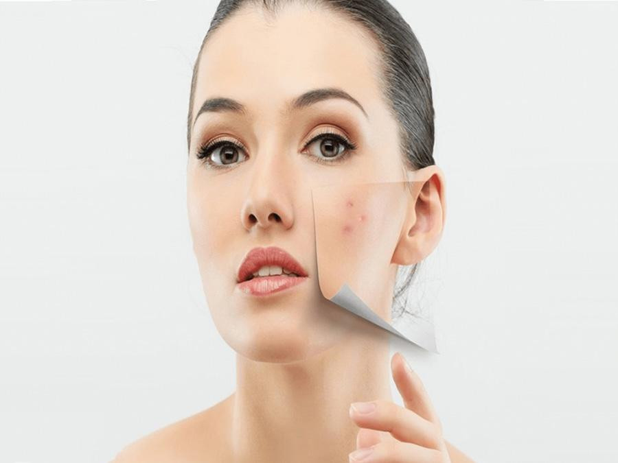 Làn da và tuổi tác có mối quan hệ mật thiết với nhau, khi con người già đi tình trạng lão hóa càng trở lên rõ ràng. Làn da và tuổi tác có mối quan hệ mật thiết với nhau, khi con người già đi tình trạng lão hóa càng trở lên rõ ràng.