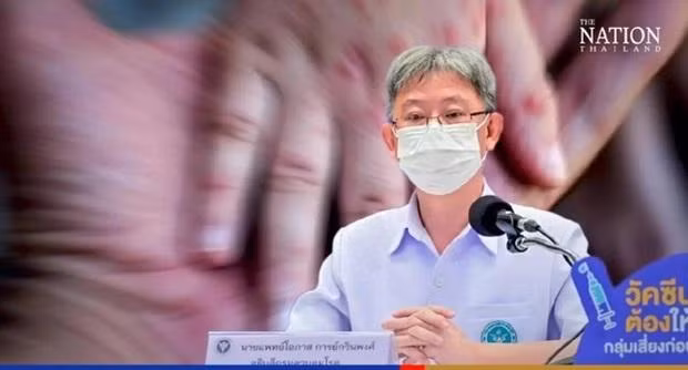 Tiến sĩ Opas Karnkawinpong - Cục trưởng Cục Kiểm soát Dịch bệnh Thái Lan (DCD). Ảnh: The Nation Thailand.