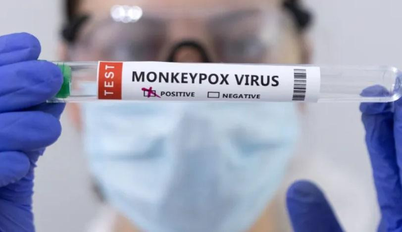 Theo Bộ Y tế ca bệnh đậu mùa khỉ xác định là trường hợp có kết quả xét nghiệm sinh học phân tử dương tính với virus đậu mùa khỉ. Dựa trên triệu chứng sốt, phát ban và hạch to, cần chẩn đoán phân biệt bệnh đậu mùa khỉ với các bệnh đậu mùa, thuỷ đậu, herpes lan tỏa và tay chân Theo Bộ Y tế ca bệnh đậu mùa khỉ xác định là trường hợp có kết quả xét nghiệm sinh học phân tử dương tính với virus đậu mùa khỉ. Dựa trên triệu chứng sốt, phát ban và hạch to, cần chẩn đoán phân biệt bệnh đậu mùa khỉ với các bệnh đậu mùa, thuỷ đậu, herpes lan tỏa và tay chân