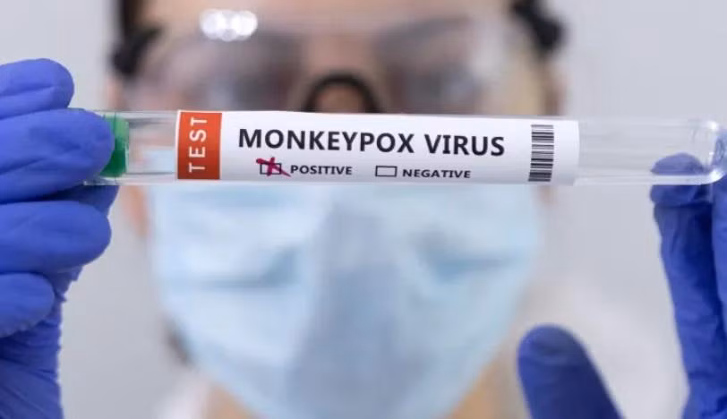 Theo Bộ Y tế ca bệnh đậu mùa khỉ xác định là trường hợp có kết quả xét nghiệm sinh học phân tử dương tính với virus đậu mùa khỉ. Dựa trên triệu chứng sốt, phát ban và hạch to, cần chẩn đoán phân biệt bệnh đậu mùa khỉ với các bệnh đậu mùa, thuỷ đậu, herpes lan tỏa và tay chân