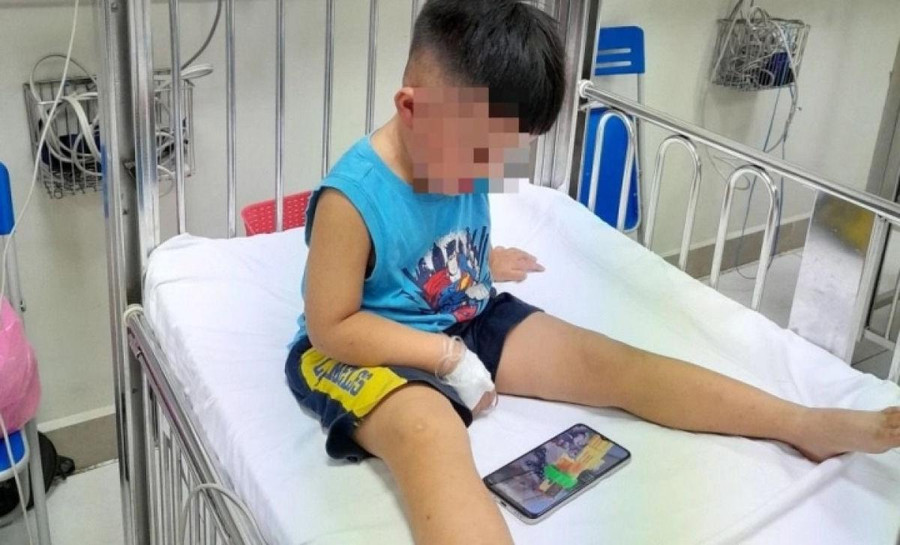 Sức khỏe của cháu bé đã ổn định nhưng vẫn cần theo dõi thêm. Ảnh: Bệnh viện cung cấp. Sức khỏe của cháu bé đã ổn định nhưng vẫn cần theo dõi thêm. Ảnh: Bệnh viện cung cấp.