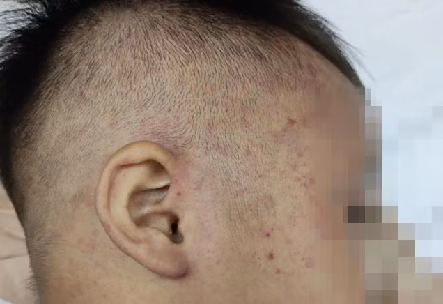 Cháu bé hơn 3 tuổi bị bạo hành, nhốt vào tủ đông lạnh. Ảnh: PD.