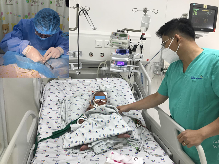 Trẻ được bộc lộ tĩnh mạch để truyền dịch, truyền máu, chế phẩm máu, kháng sinh, kháng giun, hỗ trợ hỗ hấp tuần hoàn, tình trạng cải thiện dần, tỉnh táo cai máy thở. Ảnh: BV.
