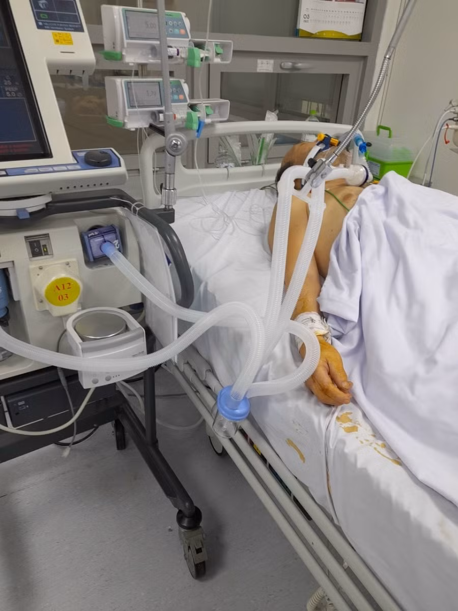 Bệnh nhân K 75 tuổi, quốc tịch Nhật Bản nhập viện trong tình trạng hôn mê tụt huyết áp, nhịp tim rời rạc 28 lần/phút phải đặt ống nội khí quản thở máy và dùng thuốc vận mạch. Nguồn: BV.