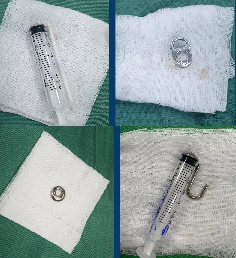 Một số hình ảnh dị vật được điều trị can thiệp tại bệnh viện trong tháng 5. Nguồn: BV.