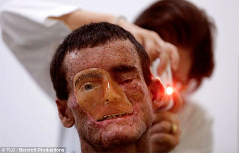 Brazil, thị trấn, bệnh hiếm