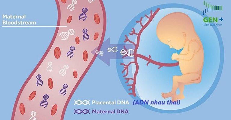 Xét nghiệm sàng lọc trước sinh NIPT được nhiều bà mẹ tin tưởng để sàng lọc hội chứng Patau. Ảnh: ITN