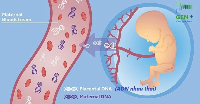 Xét nghiệm sàng lọc trước sinh NIPT được nhiều bà mẹ tin tưởng để sàng lọc hội chứng Patau. Ảnh: ITN