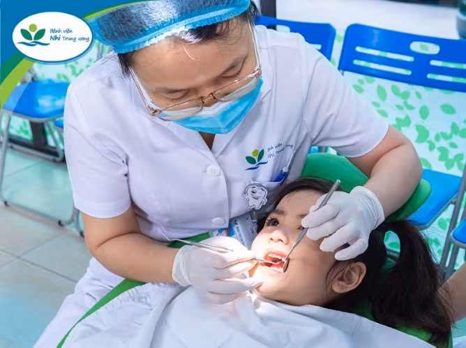 Có 4 giai đoạn phát triển của sâu răng. Ảnh minh họa