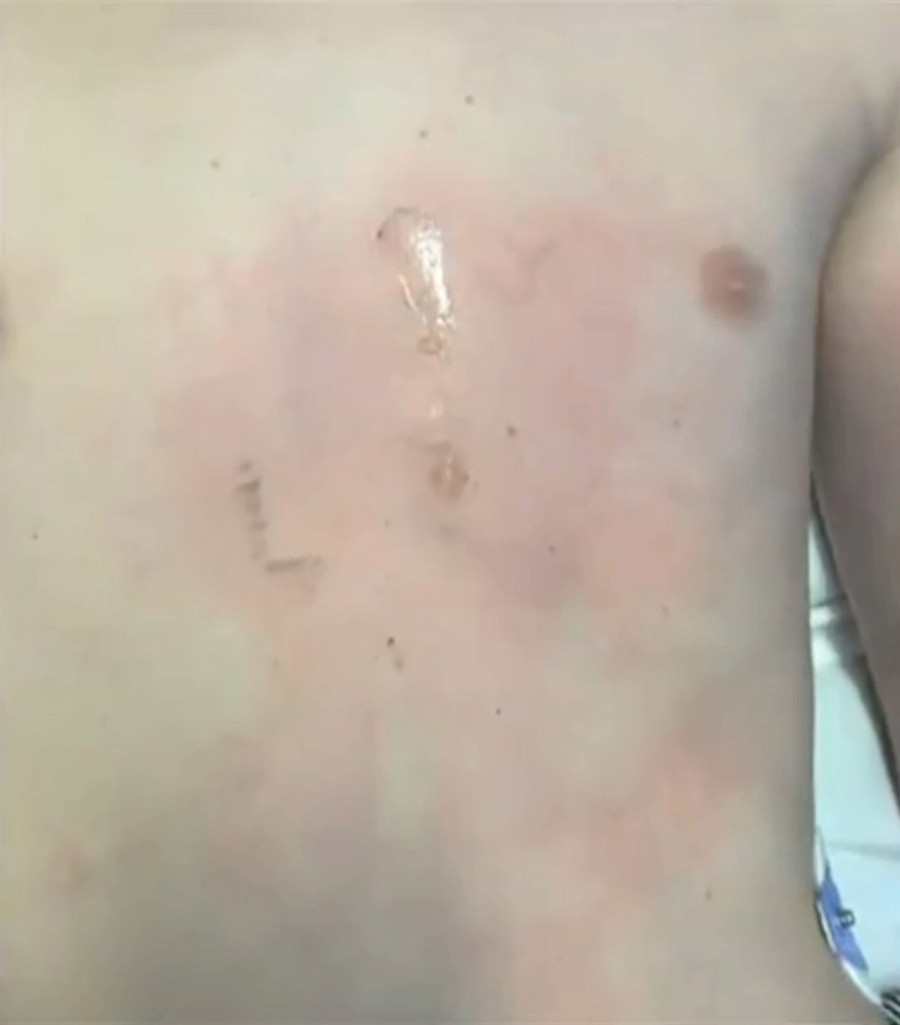 Cậu bé ngay iPhone tức được đưa đi cấp cứu.