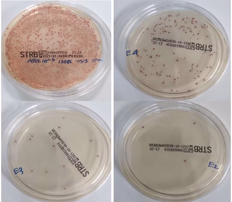 Quy trình real-time PCR cải tiến giúp phát hiện GBS nhanh, nhạy và đặc hiệu được hoàn thiện.