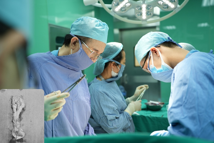 Ekip đã tiến hành phẫu thuật cắt tử cung qua ngả âm đạo, đồng thời đẩy bàng quang lên cao.