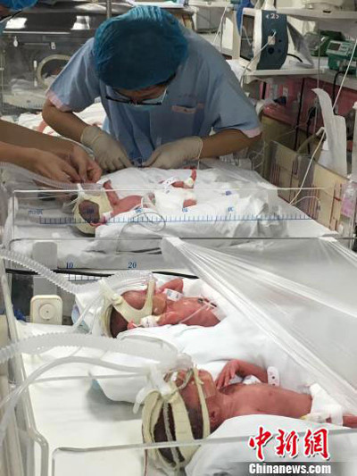 Ca sinh tư tự nhiên giống hệt nhau - Ảnh 2 Ca sinh tu tu nhien giong het nhau - Anh 2