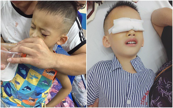 Bé Su phải phẫu thuật sau thời gian dài sử dụng điện thoại quá nhiều.