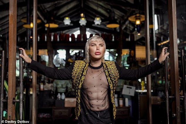 Đáng sợ gương mặt chàng trai sau... 72 lần thẩm mỹ ảnh 10 Thẩm mỹ 72 lần, anh chàng