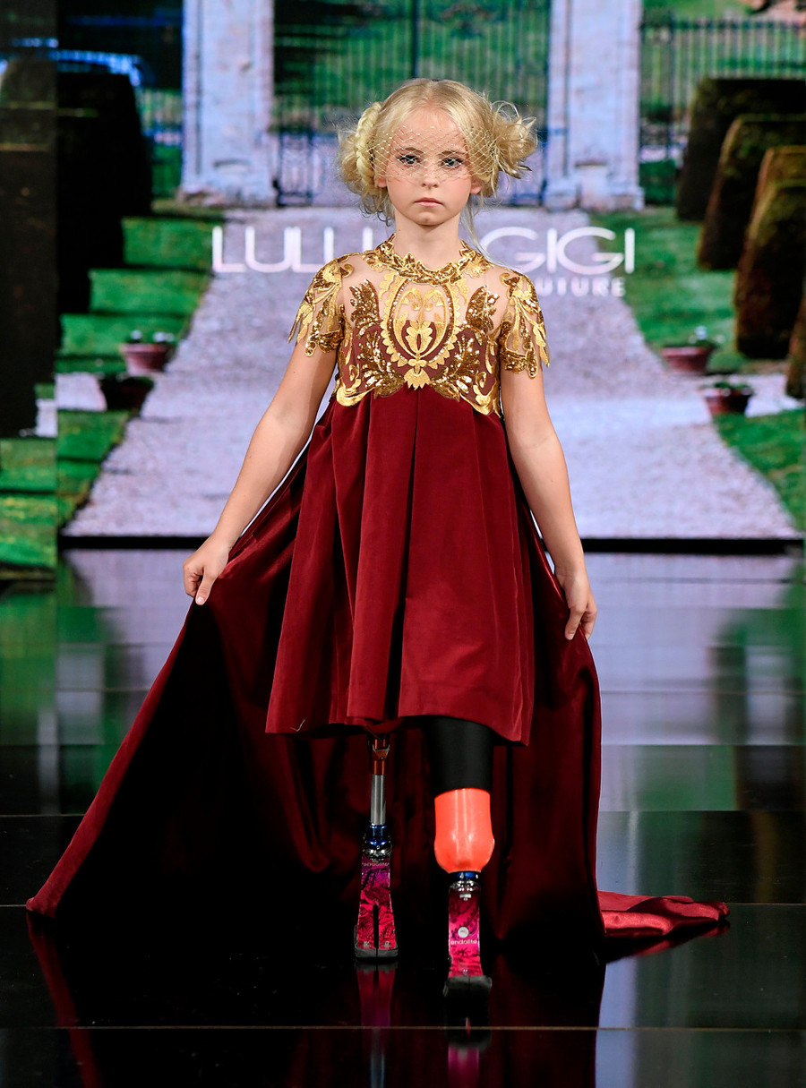 Daisy bị mắc căn bệnh thiếu xương mác. Daisy bị mắc căn bệnh thiếu xương mác.