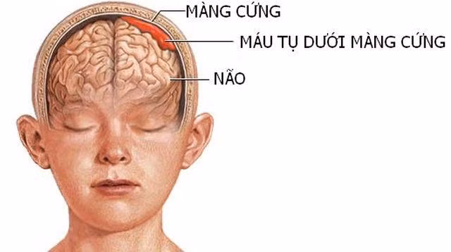 be gai 4 tuoi bi xuat huyet nao sau khi nga, canh giac khi tre co dau hieu nay - 4