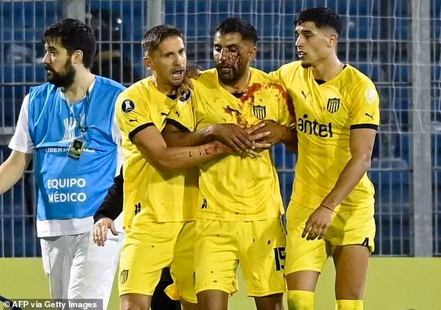 Khán giả ném đá trúng mặt khiến hậu vệ Maximiliano Olivera bị thương, máu chảy đầm đìa.