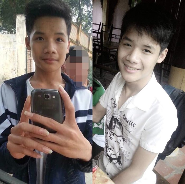 Chàng trai quyết tâm thay đổi ngoại hình để theo đuổi ước mơ và cái kết trở thành mỹ nam vạn người mê ảnh 1